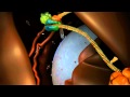 RNA interference (RNAi): by Nature Video